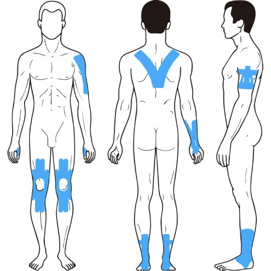 Pre-Slit Cotton Sports Muscle Patches – Body Map Application Set
